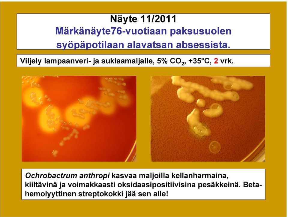 Ochrobactrum anthropi kasvaa maljoilla kellanharmaina, kiiltävinä ja