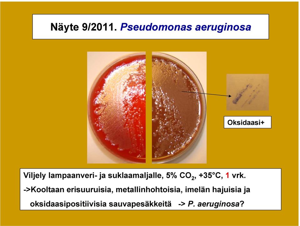 suklaamaljalle, 5% CO 2, +35 C, 1 vrk.