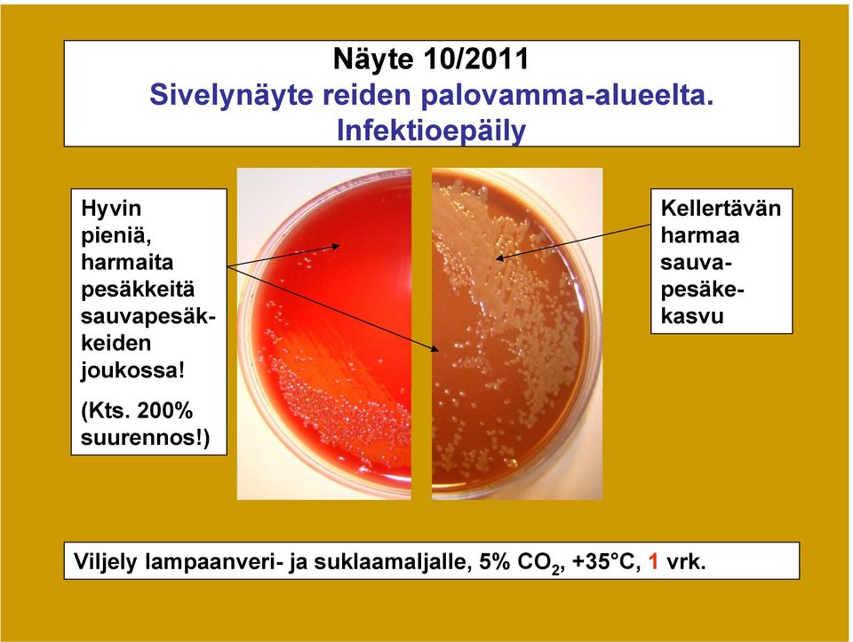 sauvapesäkkeiden joukossa!