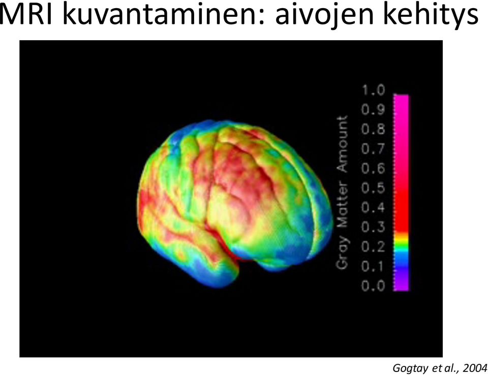 aivojen