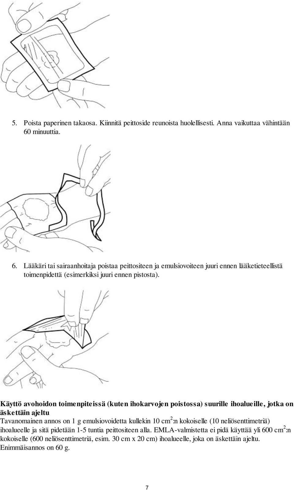 Käyttö avohoidon toimenpiteissä (kuten ihokarvojen poistossa) suurille ihoalueille, jotka on äskettäin ajeltu Tavanomainen annos on 1 g emulsiovoidetta kullekin 10 cm 2 :n