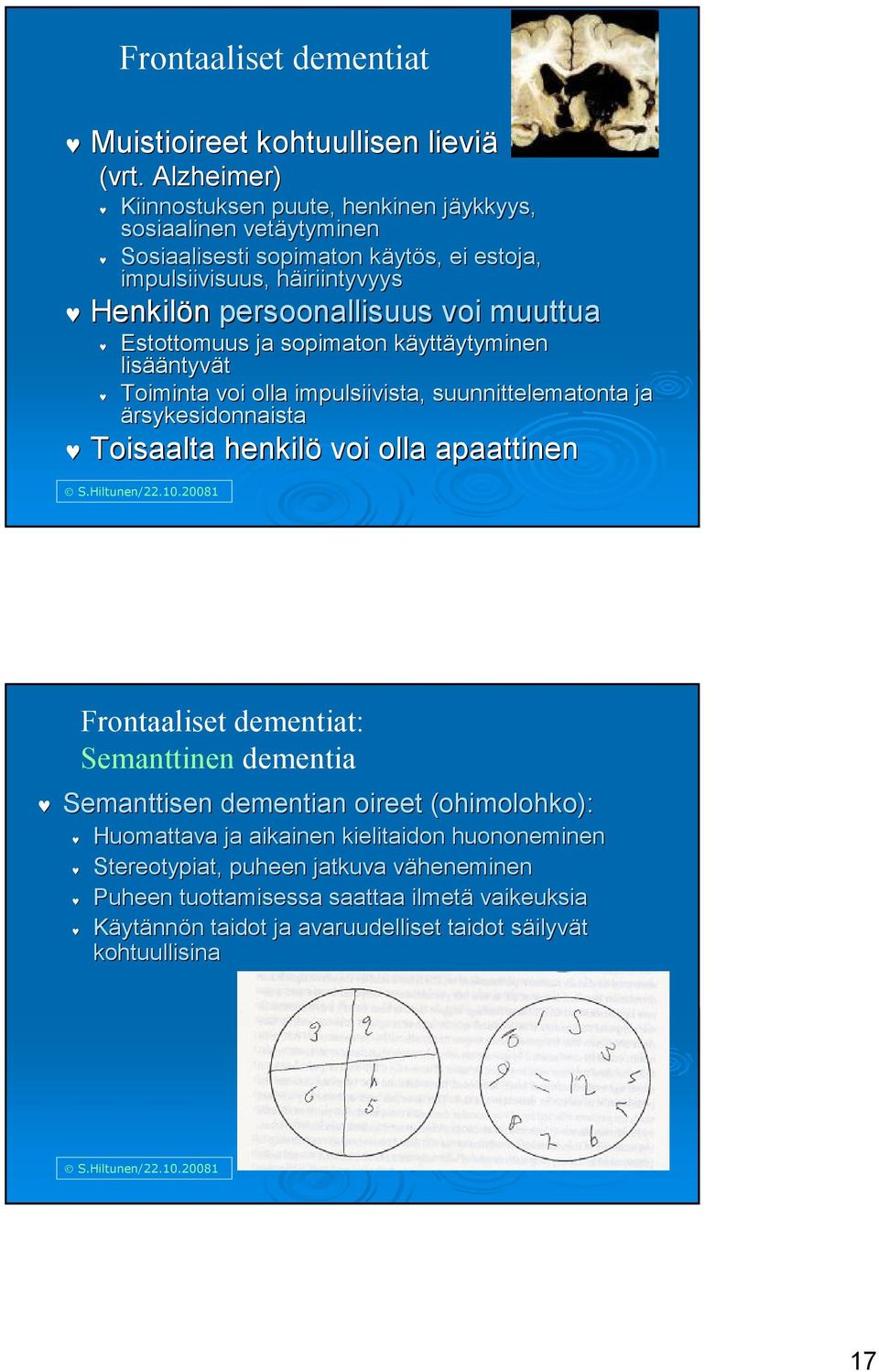 voi muuttua Estottomuus ja sopimaton käyttk yttäytyminen ytyminen lisää ääntyvät Toiminta voi olla impulsiivista, suunnittelematonta ja ärsykesidonnaista Toisaalta henkilö voi olla