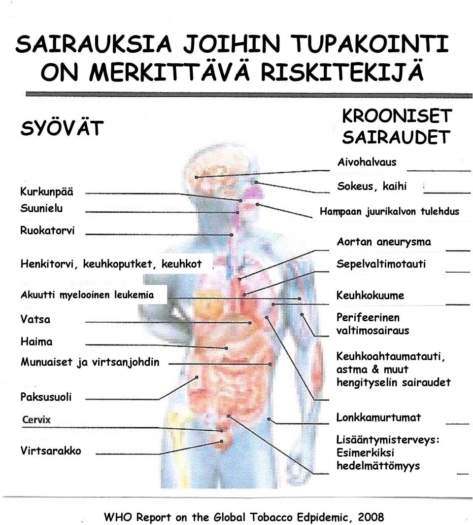 leukemia Vatsa Haima Munuaiset ja virtsanjohdin Paksusuoli Keuhkokuume Perifeerinen valtimosairaus Keuhkoahtaumatauti, astma & muut