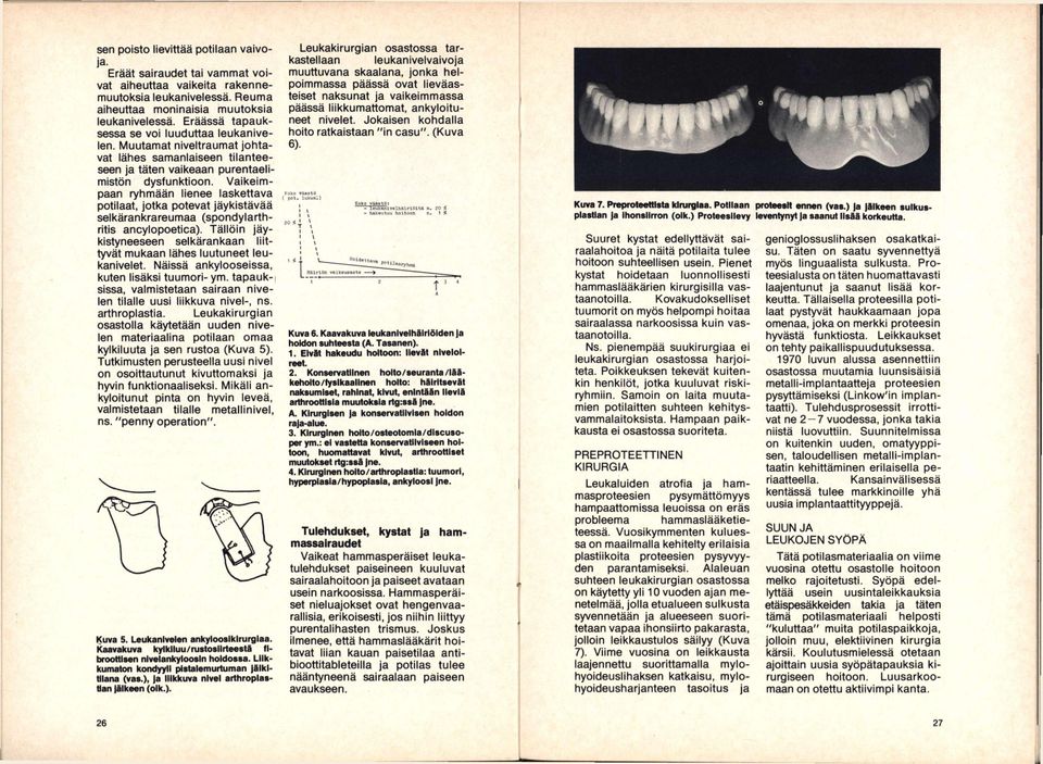 Vaikeimpaan ryhmään lienee laskettava potilaat, jotka potevat jäykistävää seikärankrareumaa (spondylarthritis ancylopoetica).