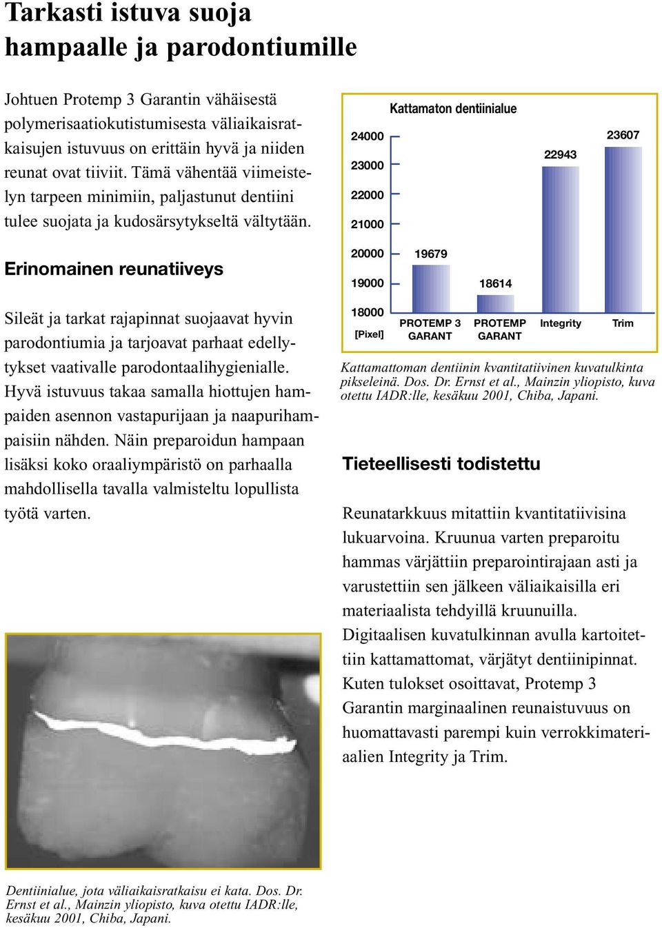 Kattamaton dentiinialue 24000 23000 22000 21000 22943 23607 Erinomainen reunatiiveys 20000 19000 19679 18614 Sileät ja tarkat rajapinnat suojaavat hyvin parodontiumia ja tarjoavat parhaat