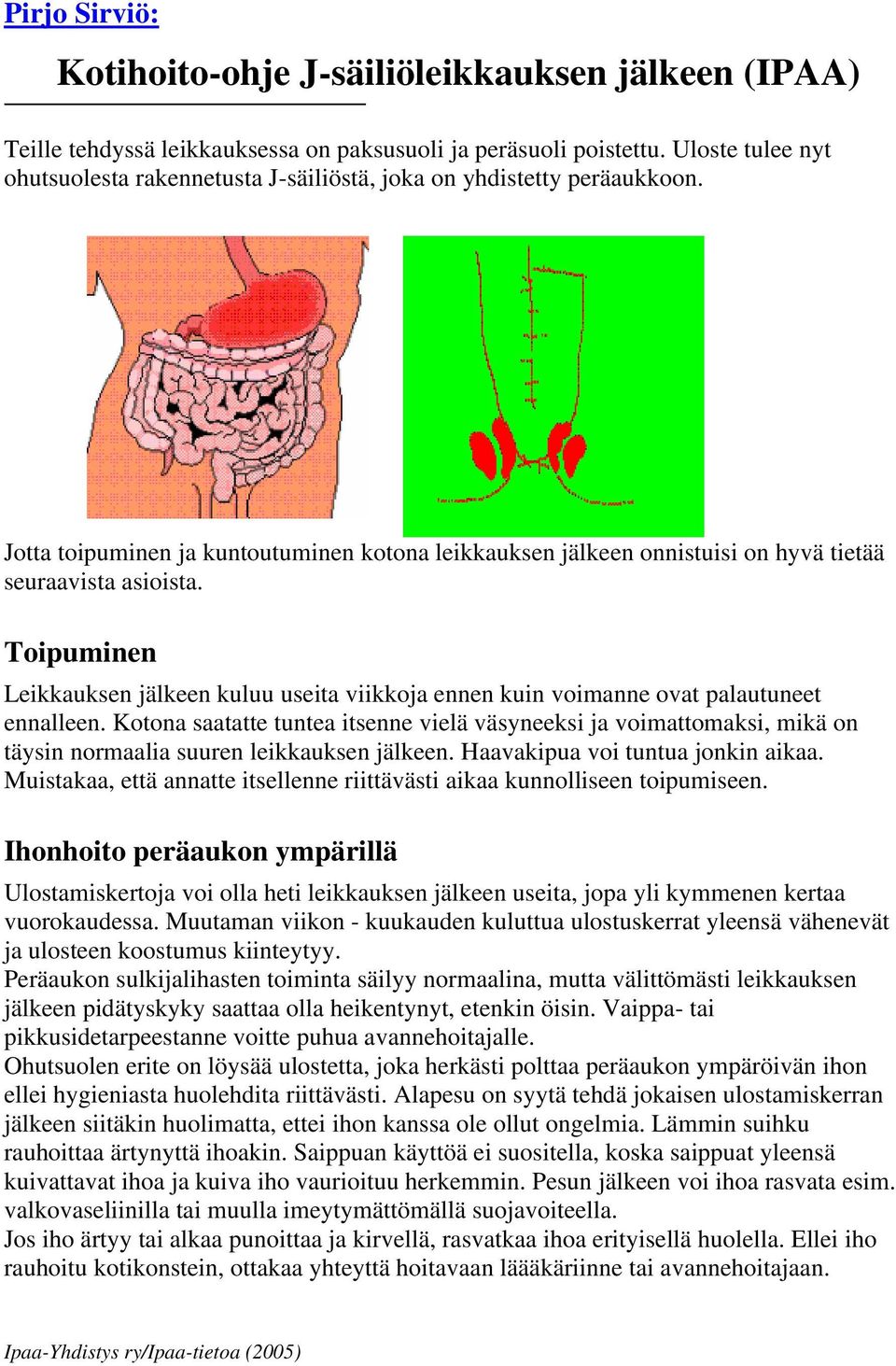 Toipuminen Leikkauksen jälkeen kuluu useita viikkoja ennen kuin voimanne ovat palautuneet ennalleen.