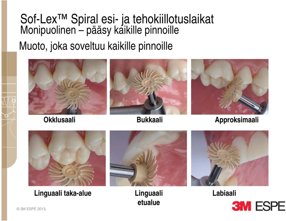 soveltuu kaikille pinnoille Okklusaali Bukkaali