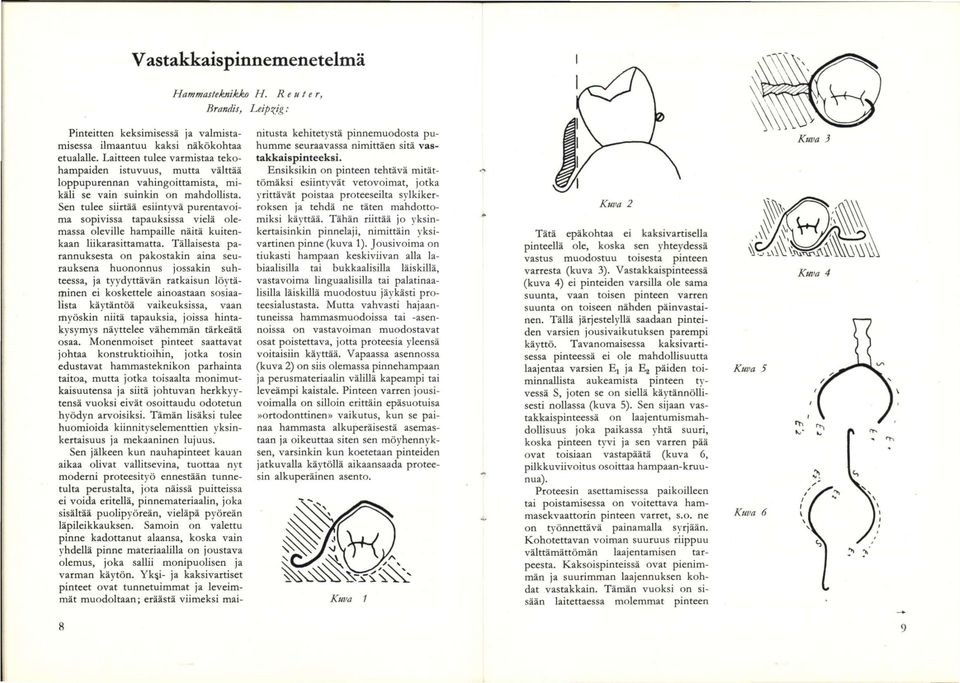 Sen tulee siirtää esiintyvä purentavoima sopivissa tapauksissa vielä olemassa oleville hampaille näitä kuitenkaan liikarasittamatta.