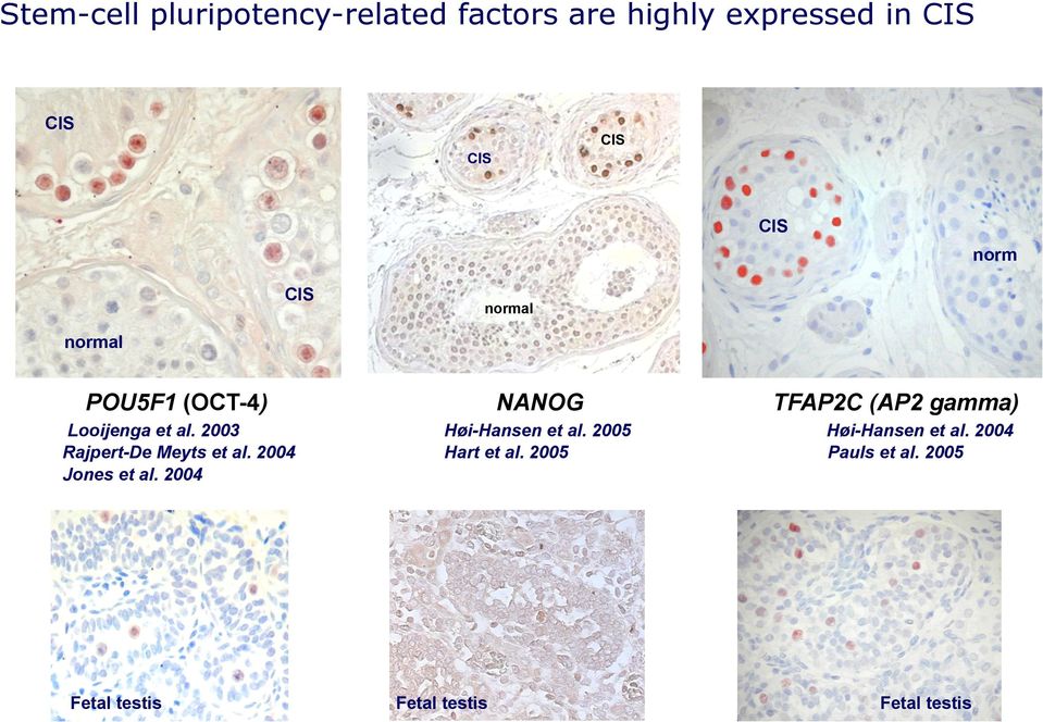 2003 Rajpert-De Meyts et al. 2004 Jones et al. 2004 Høi-Hansen et al.