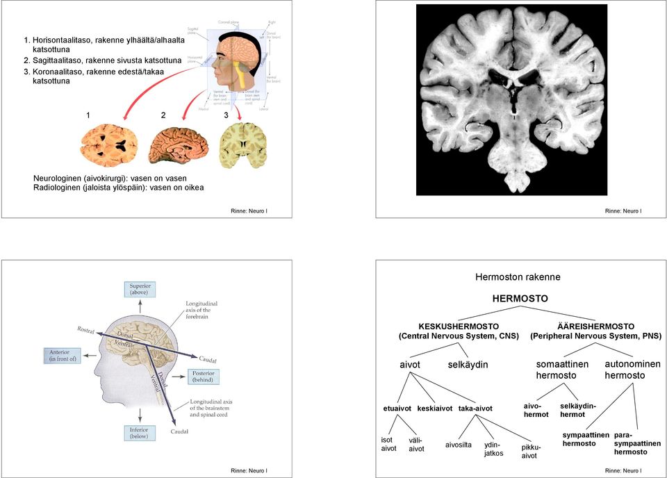 on oikea Hermoston rakenne HERMOSTO KESKUSHERMOSTO (Central Nervous System, CNS) ÄÄREISHERMOSTO (Peripheral Nervous System, PNS) aivot