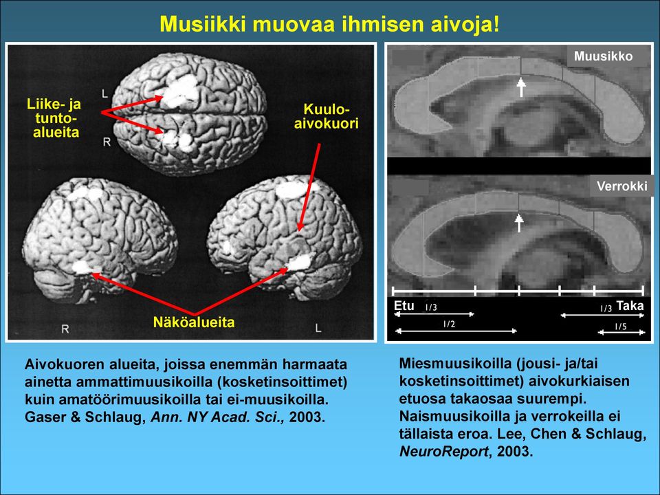 harmaata ainetta ammattimuusikoilla (kosketinsoittimet) kuin amatöörimuusikoilla tai ei-muusikoilla.