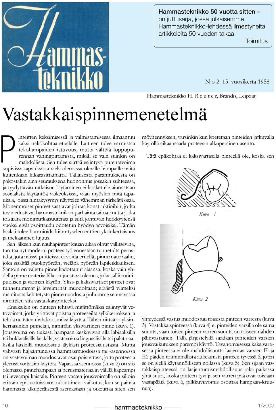 Laitteen tulee varmistaa tekohampaiden istuvuus, mutta välttää loppupurennan vahingoittamista, mikäli se vain suinkin on mahdollista.