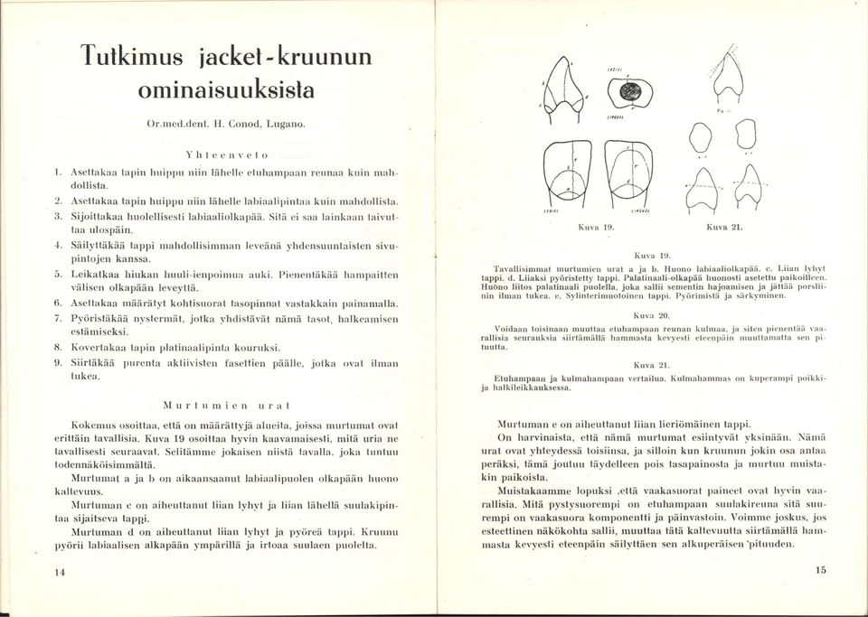 Säilyttäkää tappi mahdollisimman leveänä yhdensuuntaisten sivupintojen kanssa. 5. Leikatkaa hiukan huuli-ienpoimua auki. Pienentäkää hampaitten välisen olkapään leveyttä. 6.