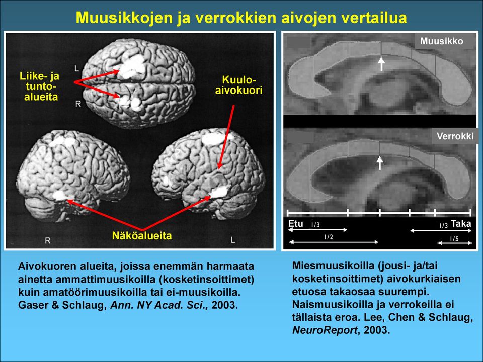 amatöörimuusikoilla tai ei-muusikoilla. Gaser & Schlaug, Ann. NY Acad. Sci., 2003.