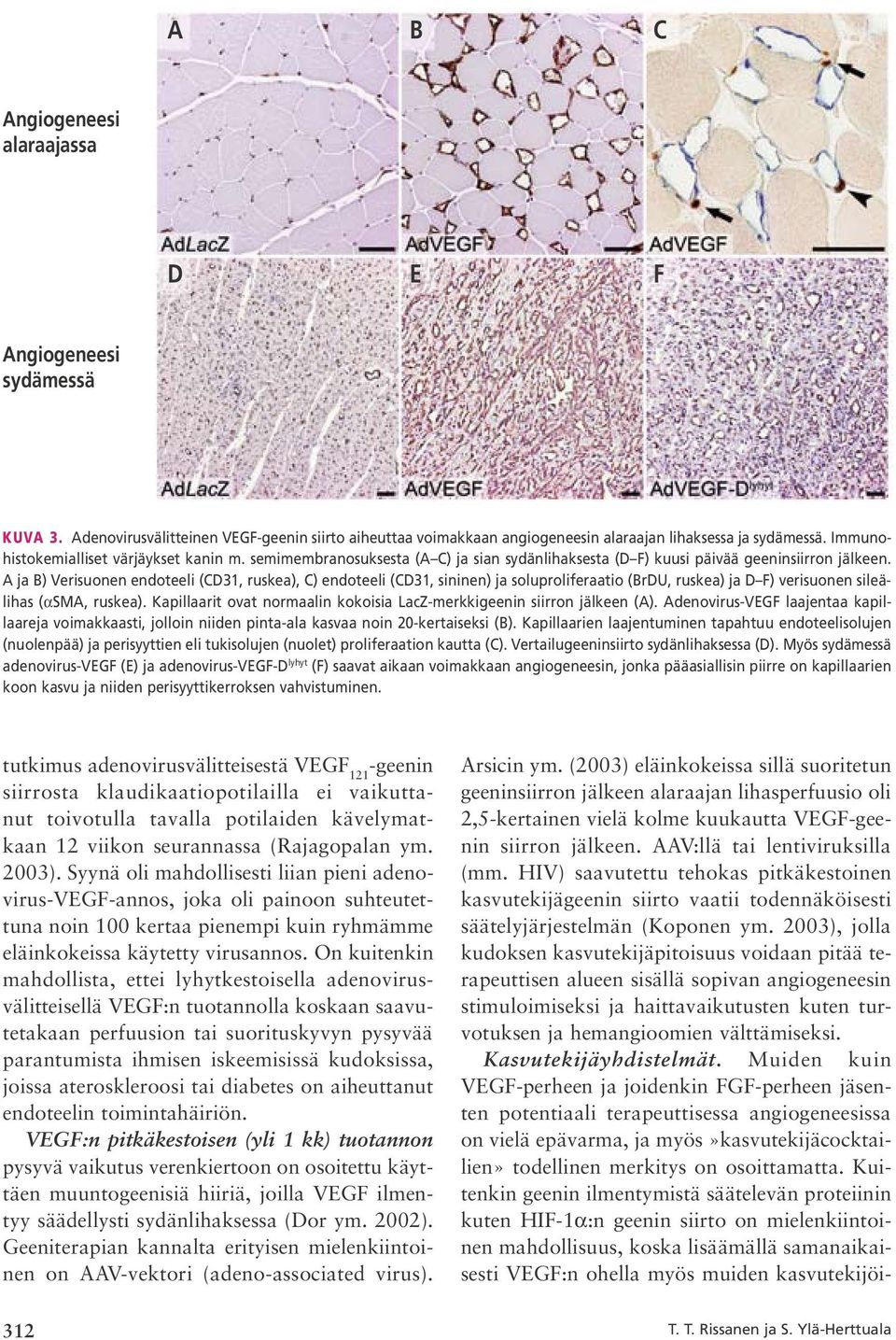 A ja B) Verisuonen endoteeli (CD31, ruskea), C) endoteeli (CD31, sininen) ja soluproliferaatio (BrDU, ruskea) ja D F) verisuonen sileälihas (αsma, ruskea).