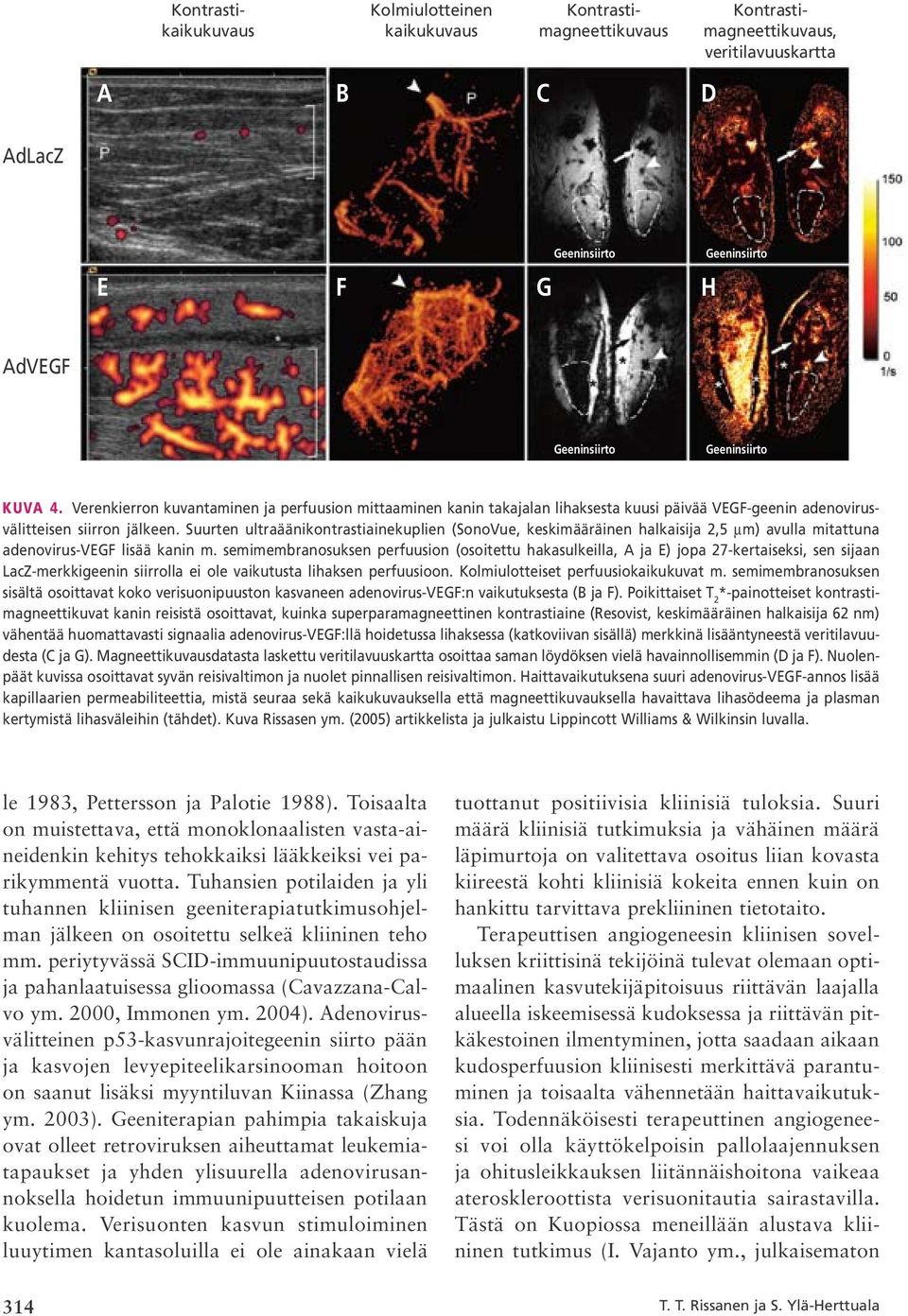 Suurten ultraäänikontrastiainekuplien (SonoVue, keskimääräinen halkaisija 2,5 µm) avulla mitattuna adenovirus VEGF lisää kanin m.