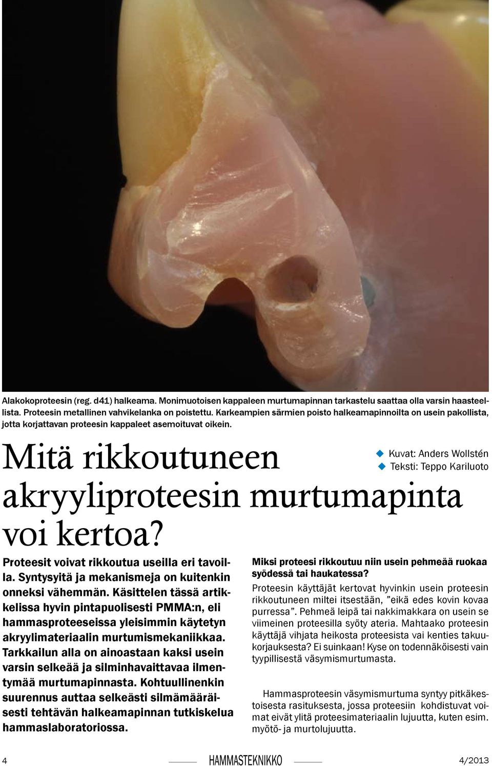 Proteesit voivat rikkoutua useilla eri tavoilla. Syntysyitä ja mekanismeja on kuitenkin onneksi vähemmän.