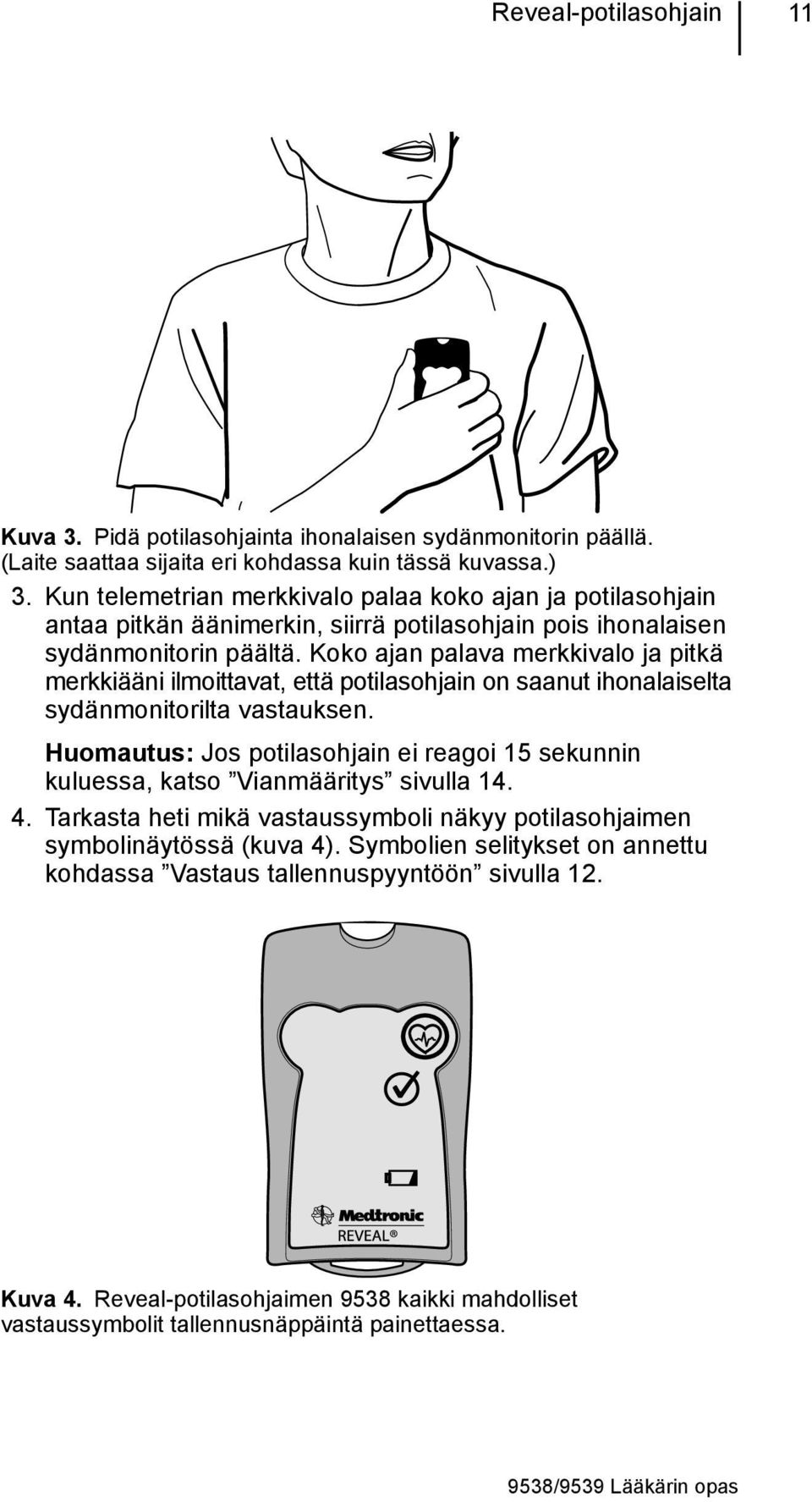 Koko ajan palava merkkivalo ja pitkä merkkiääni ilmoittavat, että potilasohjain on saanut ihonalaiselta sydänmonitorilta vastauksen.