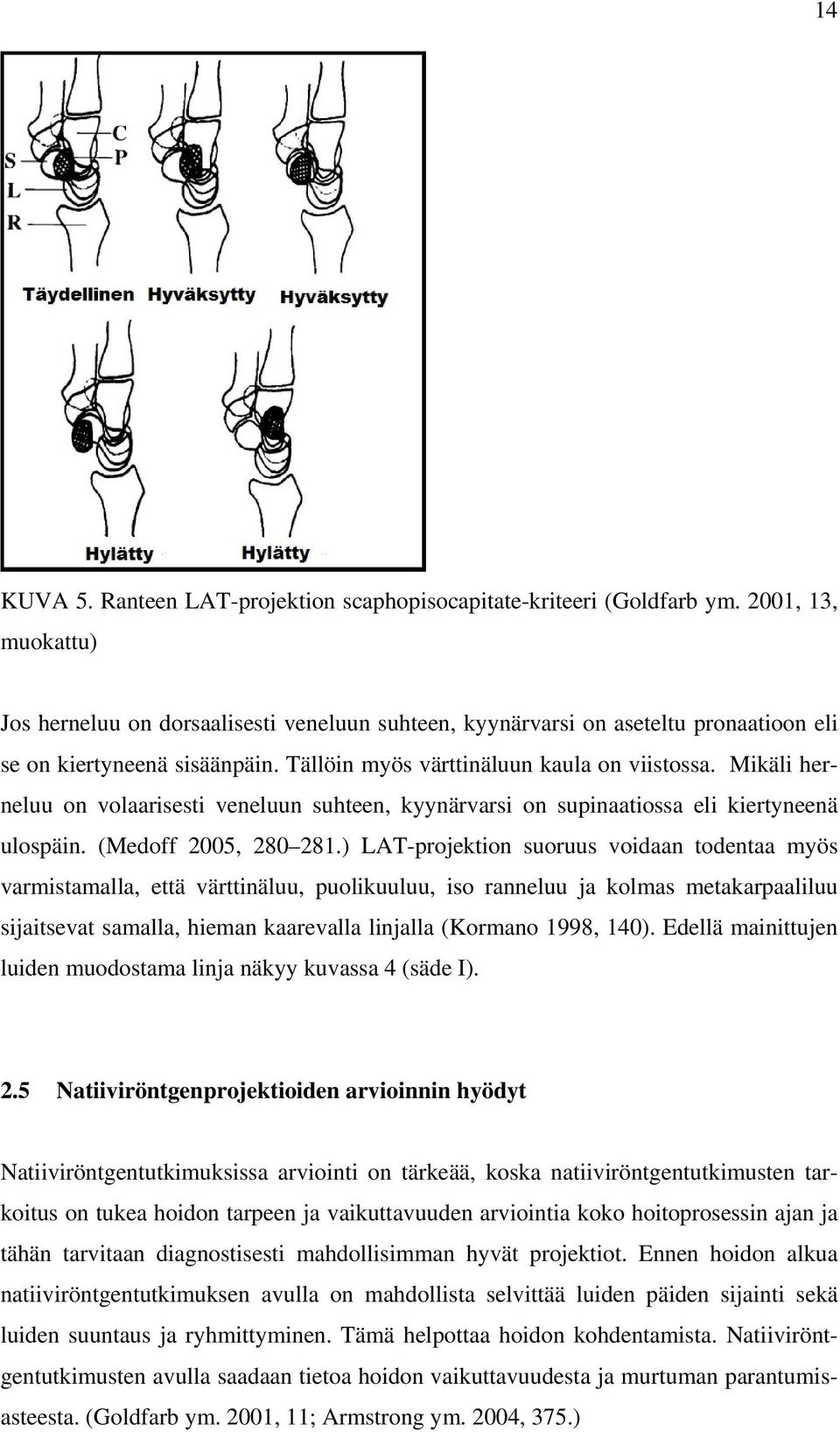 Mikäli herneluu on volaarisesti veneluun suhteen, kyynärvarsi on supinaatiossa eli kiertyneenä ulospäin. (Medoff 2005, 280 281.