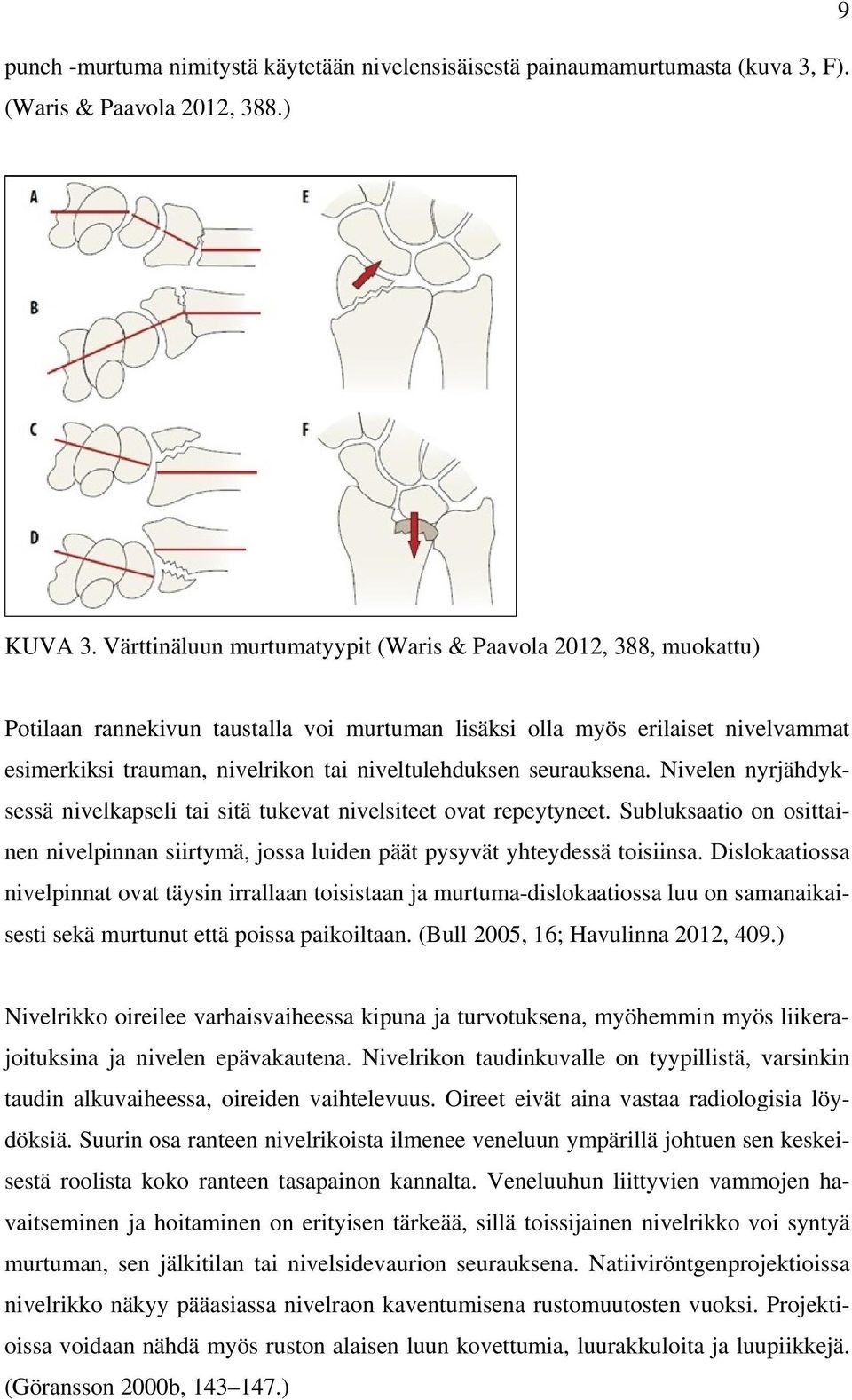 niveltulehduksen seurauksena. Nivelen nyrjähdyksessä nivelkapseli tai sitä tukevat nivelsiteet ovat repeytyneet.