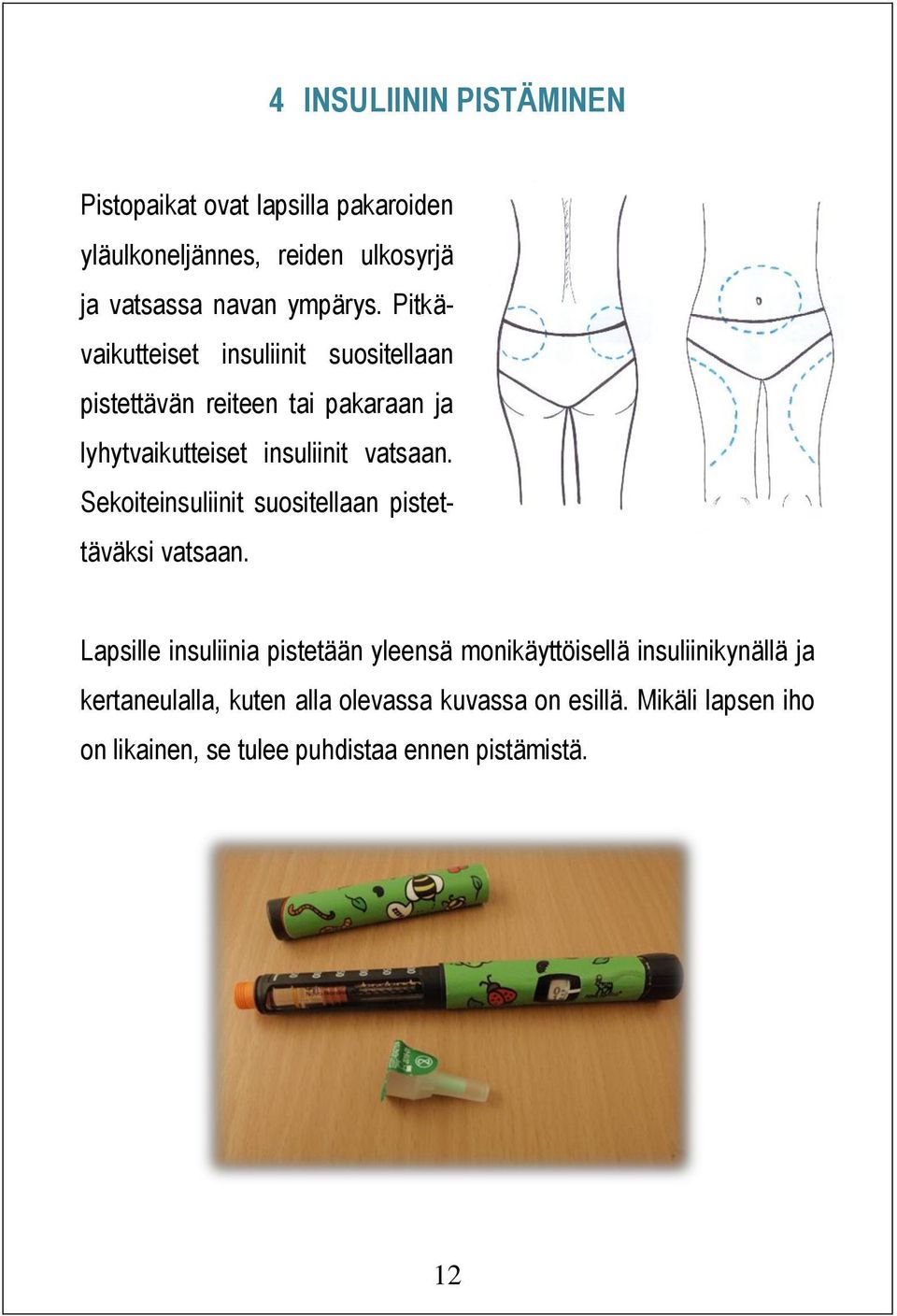 Sekoiteinsuliinit suositellaan pistettäväksi vatsaan.