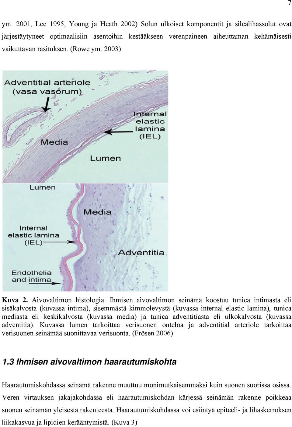 Ihmisen aivovaltimon seinämä koostuu tunica intimasta eli sisäkalvosta (kuvassa intima), sisemmästä kimmolevystä (kuvassa internal elastic lamina), tunica mediasta eli keskikalvosta (kuvassa media)