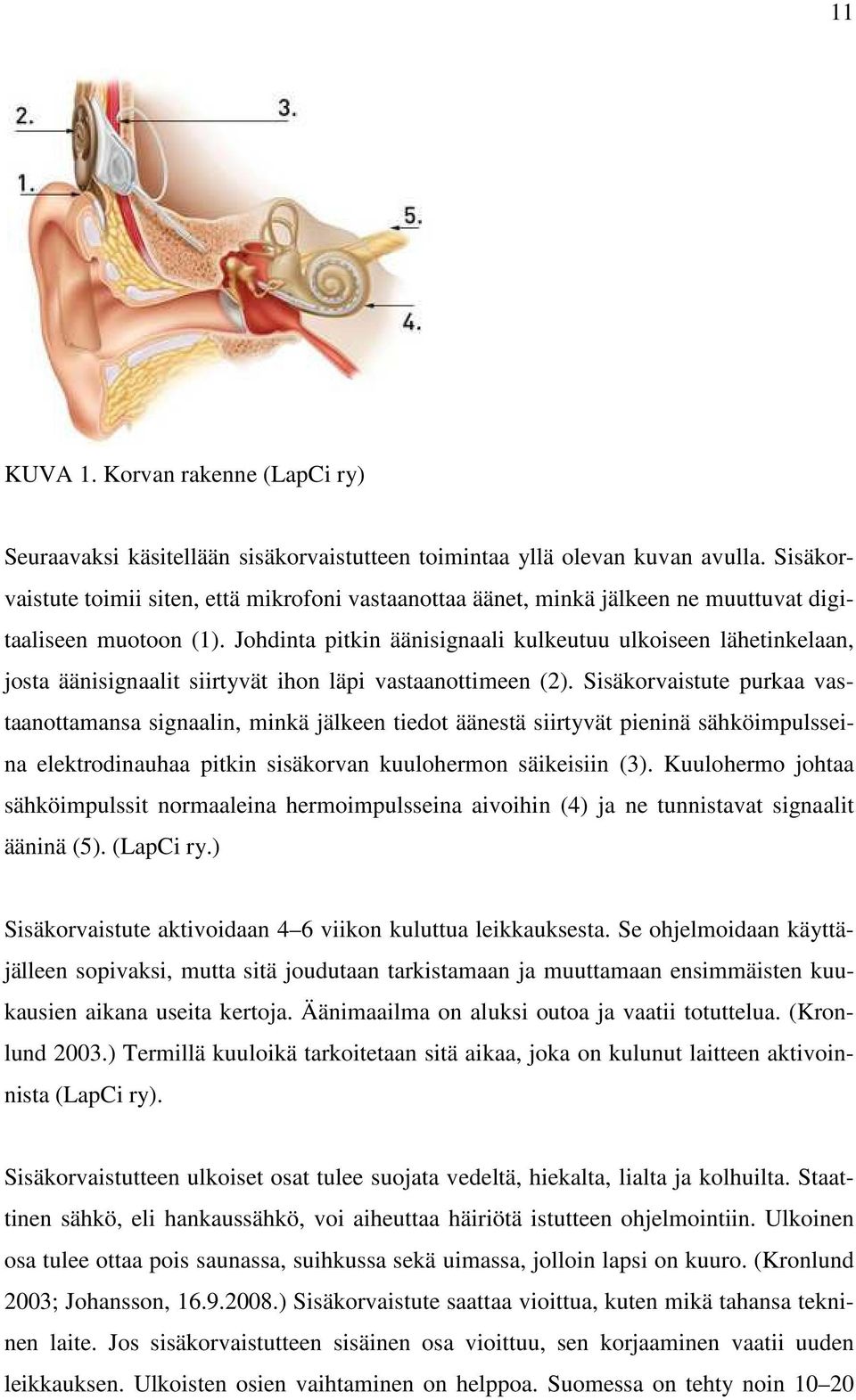 Johdinta pitkin äänisignaali kulkeutuu ulkoiseen lähetinkelaan, josta äänisignaalit siirtyvät ihon läpi vastaanottimeen (2).