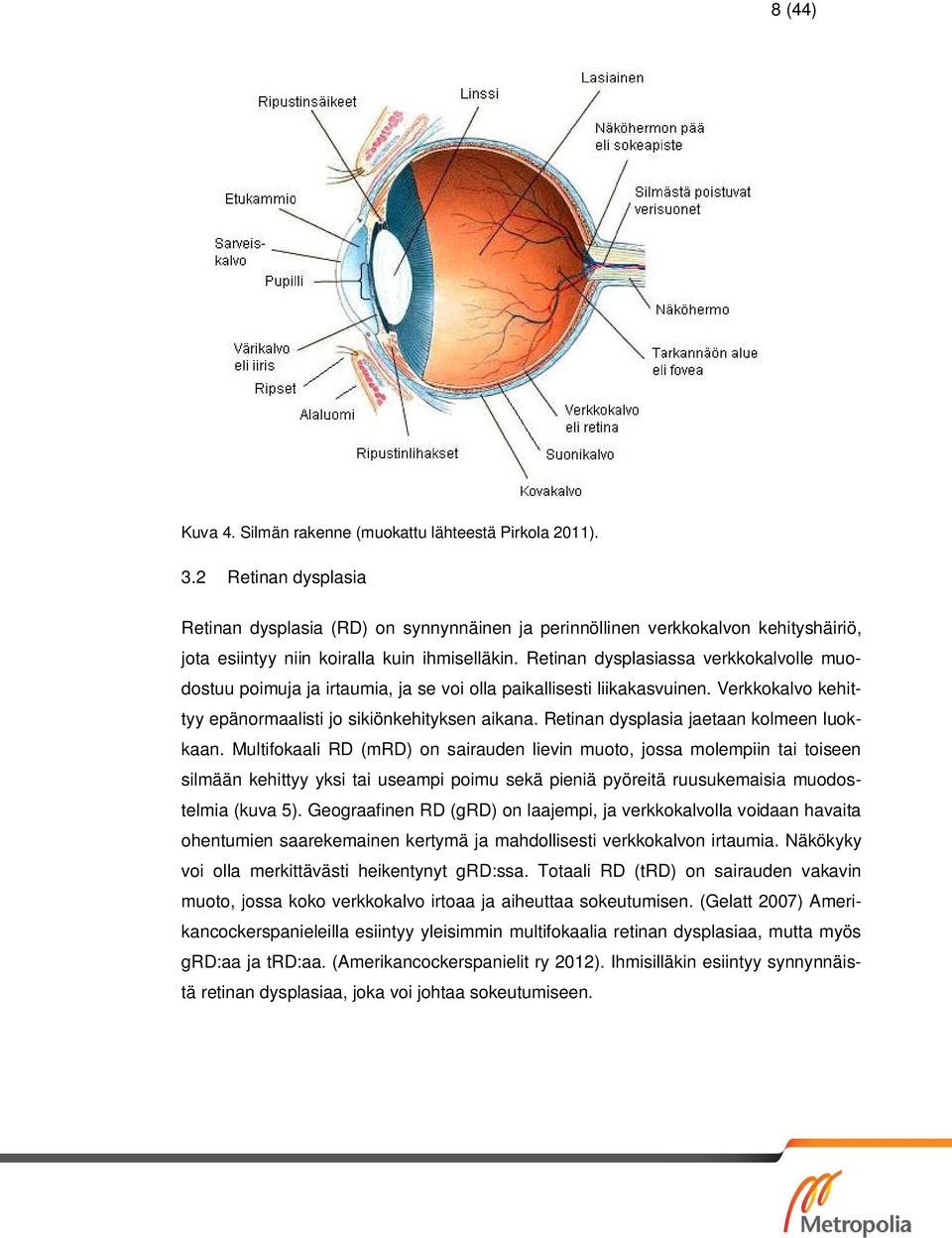 Retinan dysplasiassa verkkokalvolle muodostuu poimuja ja irtaumia, ja se voi olla paikallisesti liikakasvuinen. Verkkokalvo kehittyy epänormaalisti jo sikiönkehityksen aikana.