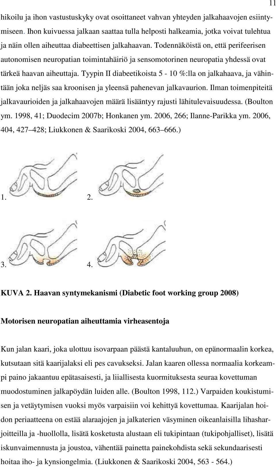 Todennäköistä on, että perifeerisen autonomisen neuropatian toimintahäiriö ja sensomotorinen neuropatia yhdessä ovat tärkeä haavan aiheuttaja.