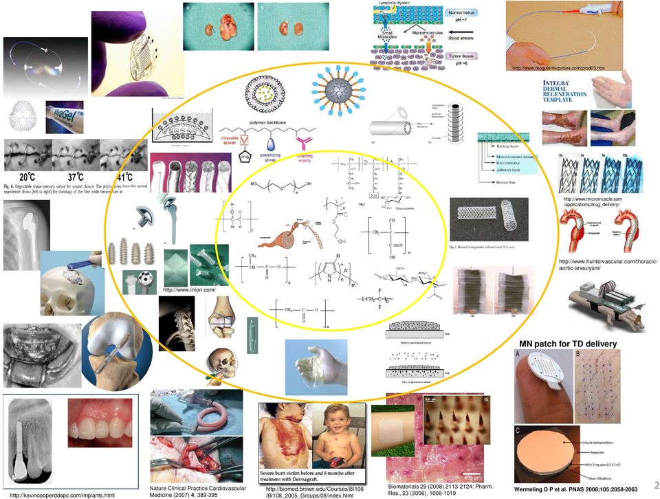 com/implants.html Nature Clinical Practice Cardiovascular Medicine (2007) 4, 389-395 http://biomed.brown.