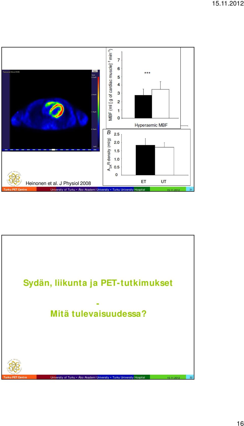 2012 31 Sydän, liikunta ja