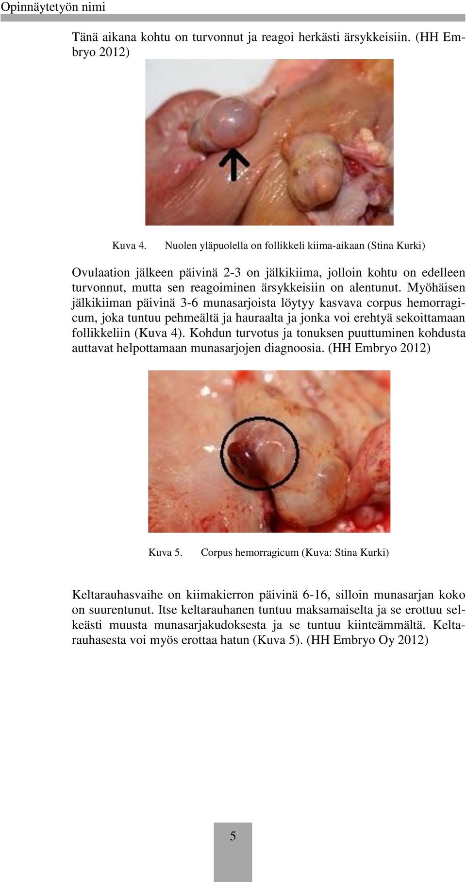 Myöhäisen jälkikiiman päivinä 3-6 munasarjista löytyy kasvava crpus hemrragicum, jka tuntuu pehmeältä ja hauraalta ja jnka vi erehtyä sekittamaan fllikkeliin (Kuva 4).