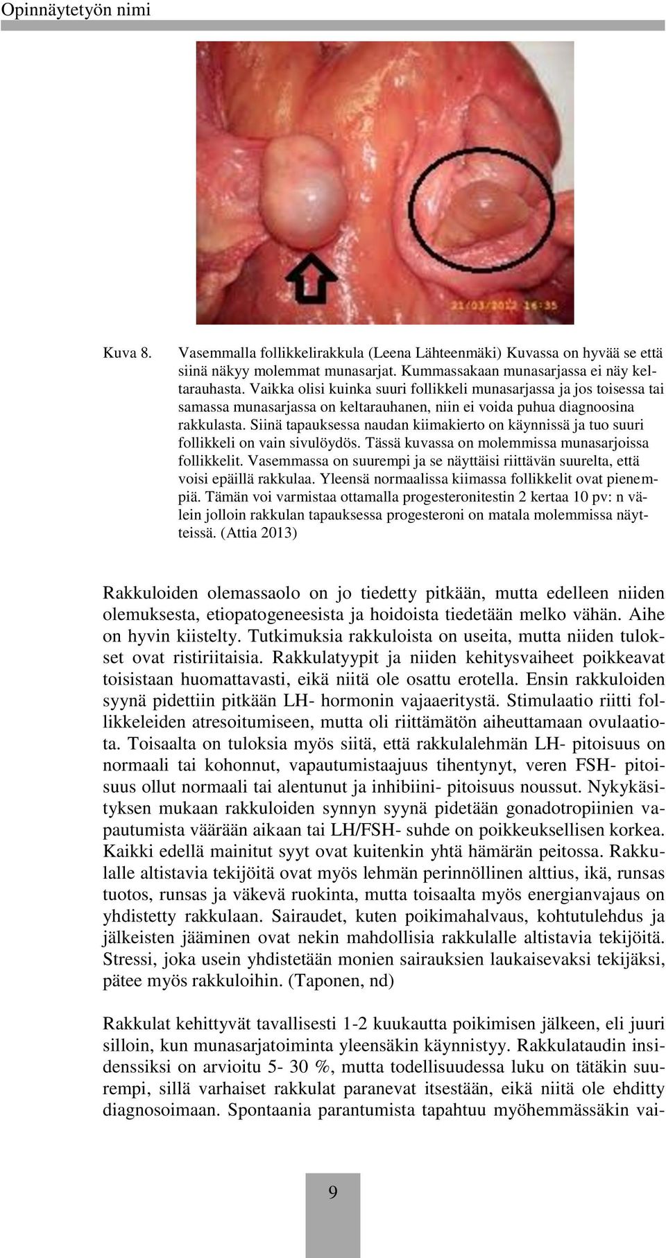Siinä tapauksessa naudan kiimakiert n käynnissä ja tu suuri fllikkeli n vain sivulöydös. Tässä kuvassa n mlemmissa munasarjissa fllikkelit.