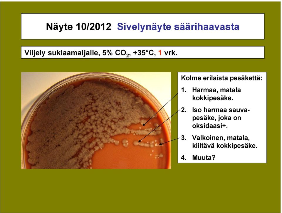 Kolme erilaista pesäkettä: 1. Harmaa, matala kokkipesäke. 2.