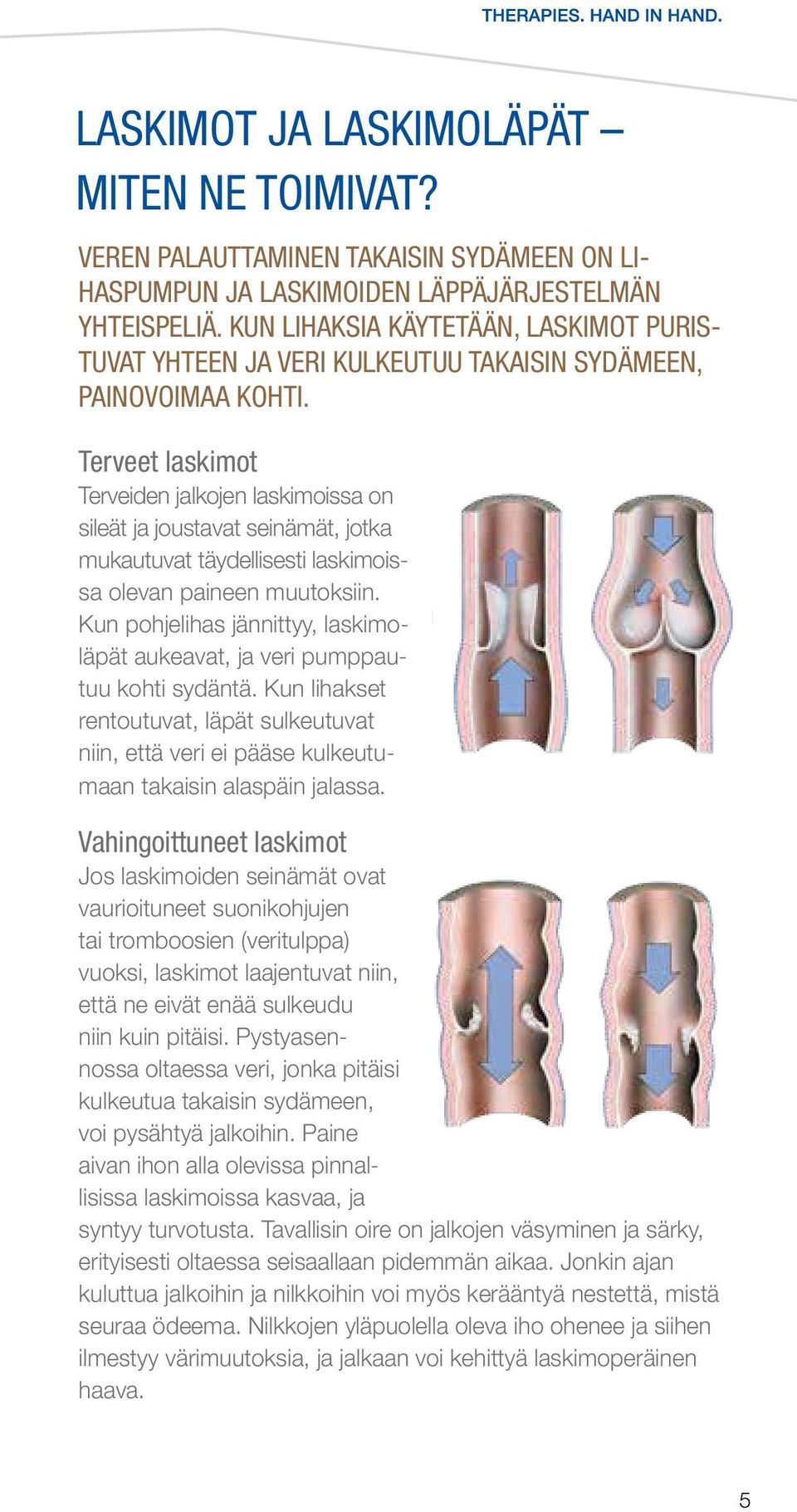 Terveet laskimot Terveiden jalkojen laskimoissa on sileät ja joustavat seinämät, jotka mukautuvat täydellisesti laskimoissa olevan paineen muutoksiin.