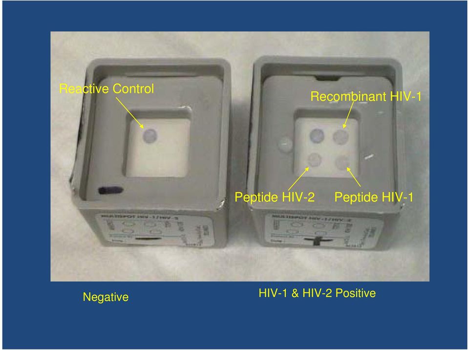 Peptide HIV-2 Peptide