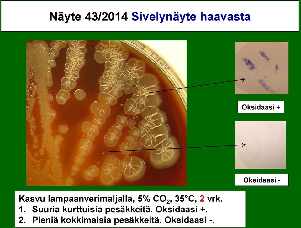 1. Suuria kurttuisia pesäkkeitä. Oksidaasi +. 2.