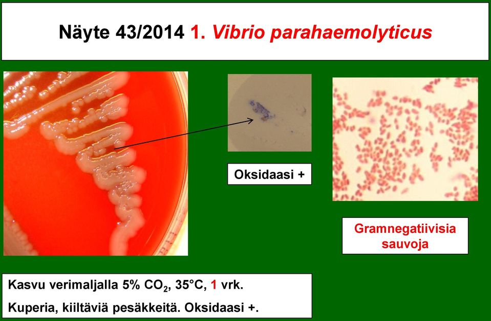 Gramnegatiivisia sauvoja Kasvu