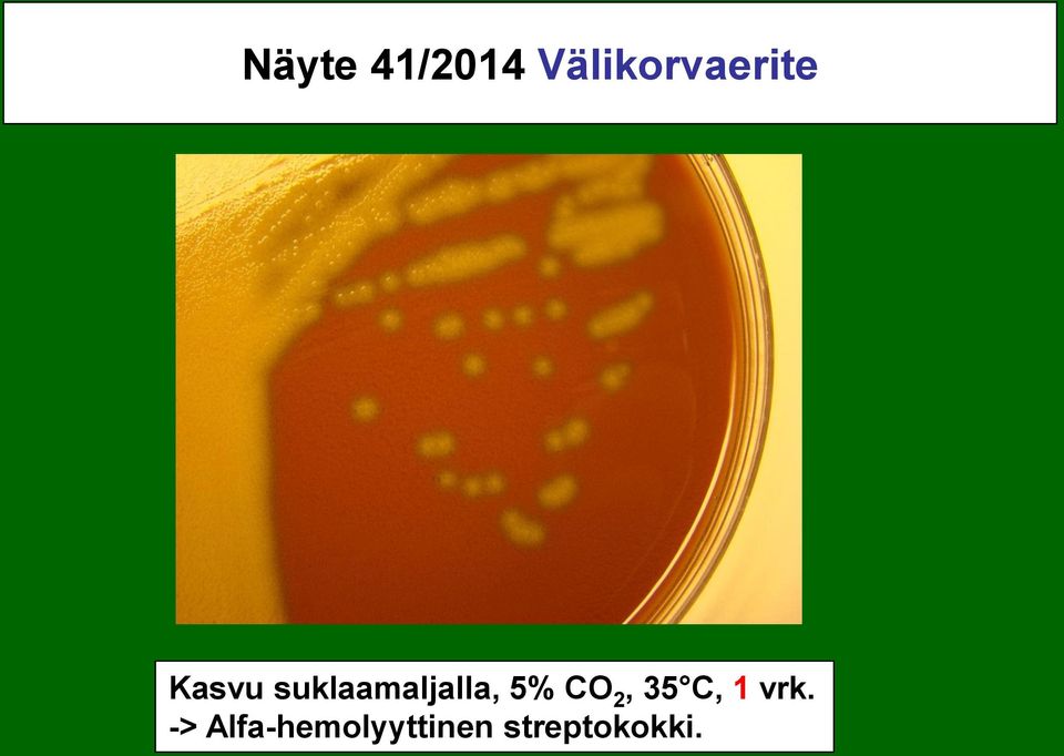 suklaamaljalla, 5% CO 2,