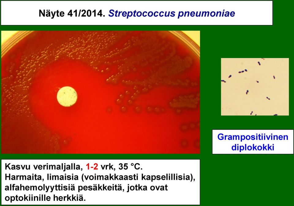 35 C. Harmaita, limaisia (voimakkaasti