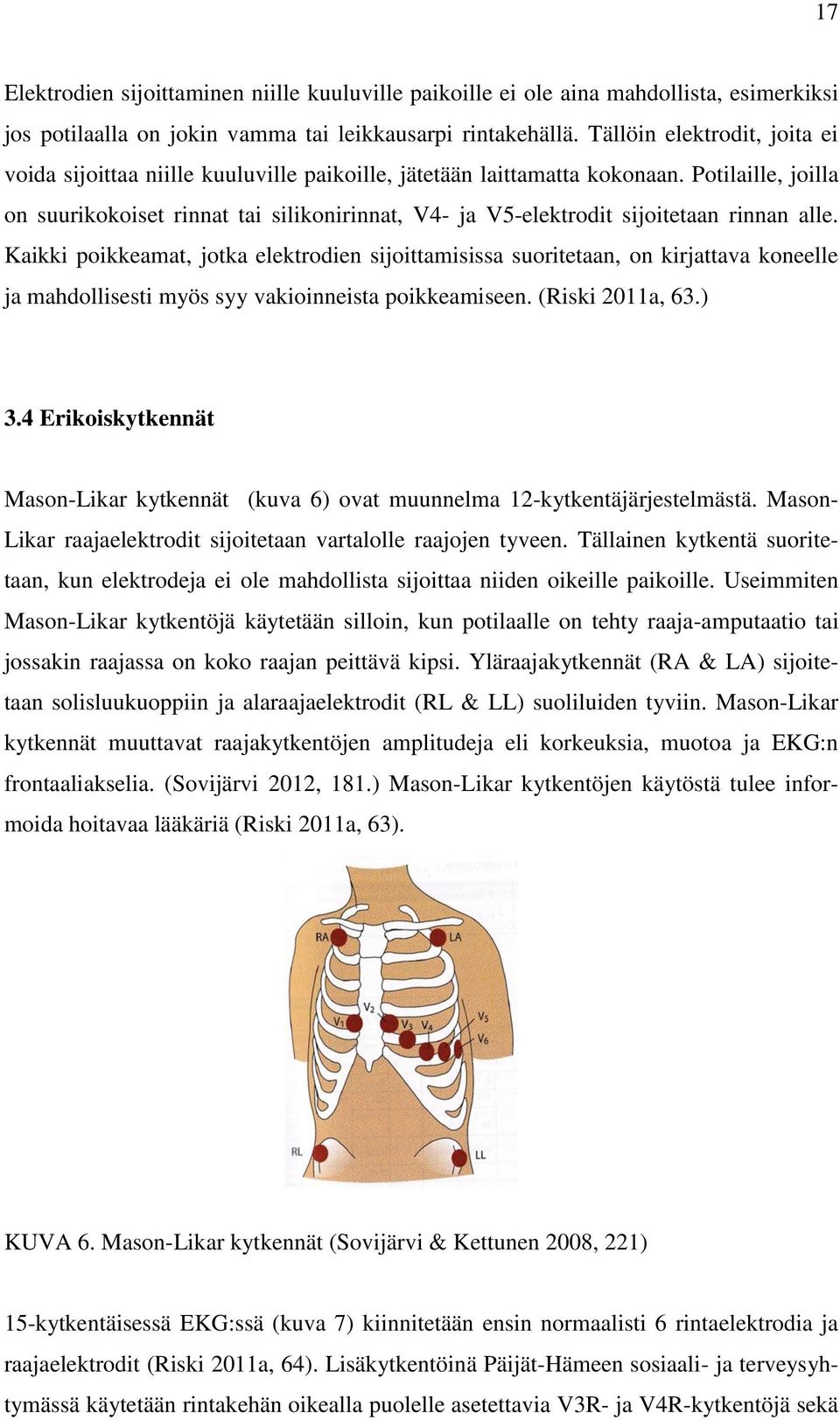 Potilaille, joilla on suurikokoiset rinnat tai silikonirinnat, V4- ja V5-elektrodit sijoitetaan rinnan alle.