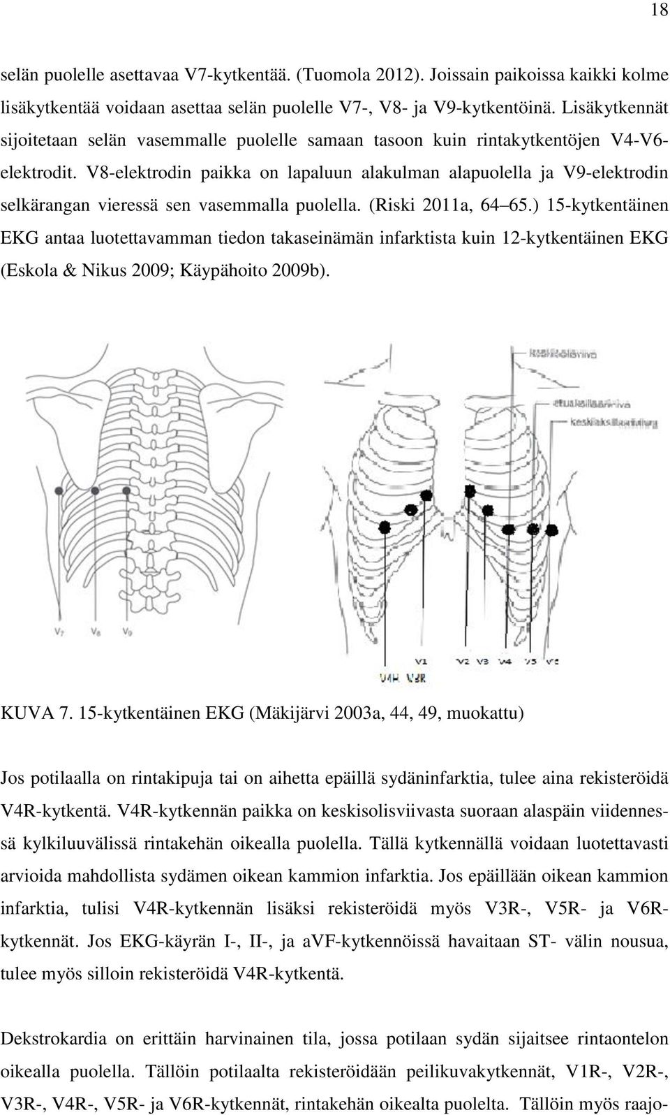 V8-elektrodin paikka on lapaluun alakulman alapuolella ja V9-elektrodin selkärangan vieressä sen vasemmalla puolella. (Riski 2011a, 64 65.