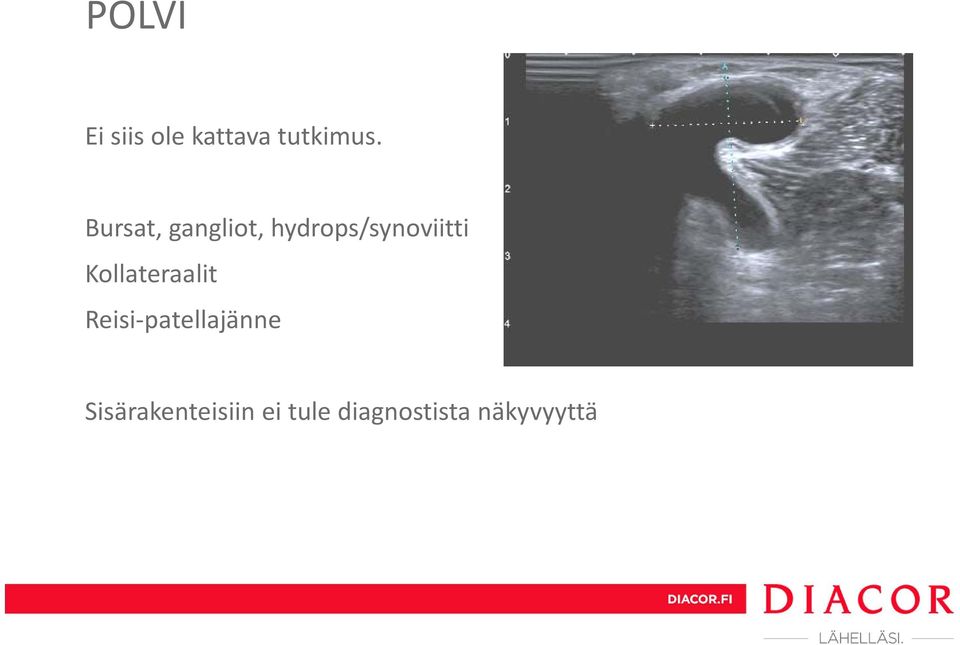 Kollateraalit Reisi patellajänne