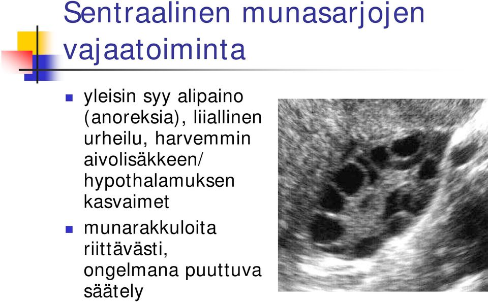 harvemmin aivolisäkkeen/ hypothalamuksen