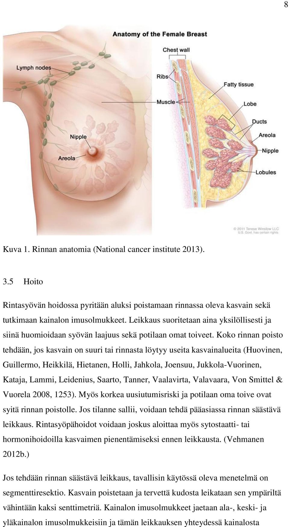 Koko rinnan poisto tehdään, jos kasvain on suuri tai rinnasta löytyy useita kasvainalueita (Huovinen, Guillermo, Heikkilä, Hietanen, Holli, Jahkola, Joensuu, Jukkola-Vuorinen, Kataja, Lammi,