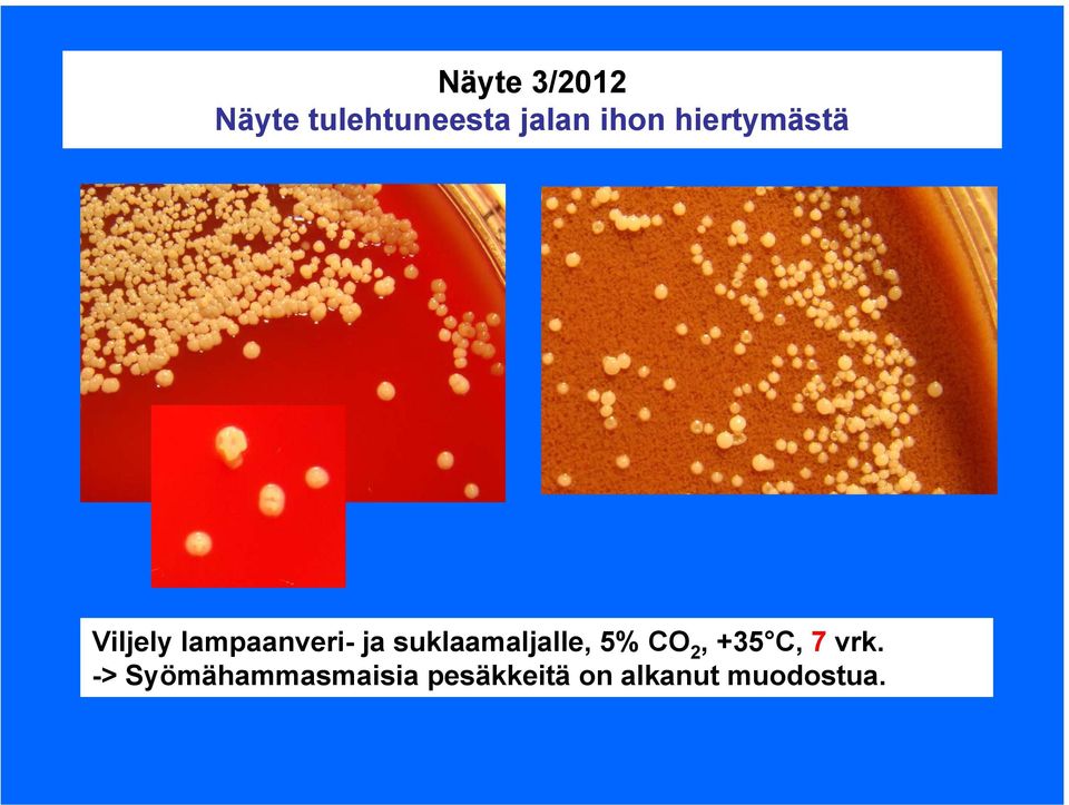 suklaamaljalle, 5% CO 2, +35 C, 7 vrk.