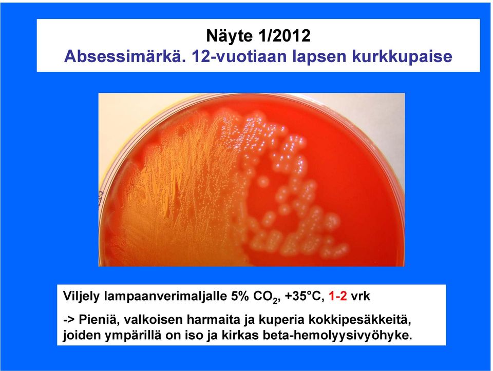 lampaanverimaljalle 5% CO 2, +35 C, 1-2 vrk -> Pieniä,