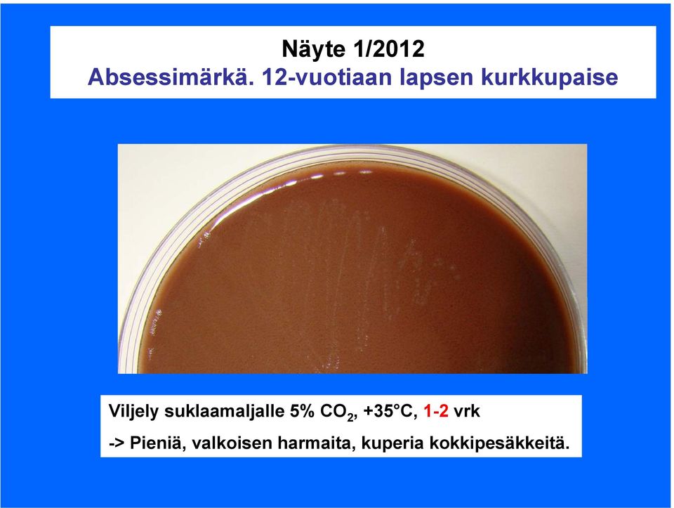 suklaamaljalle 5% CO 2, +35 C, 1-2 vrk