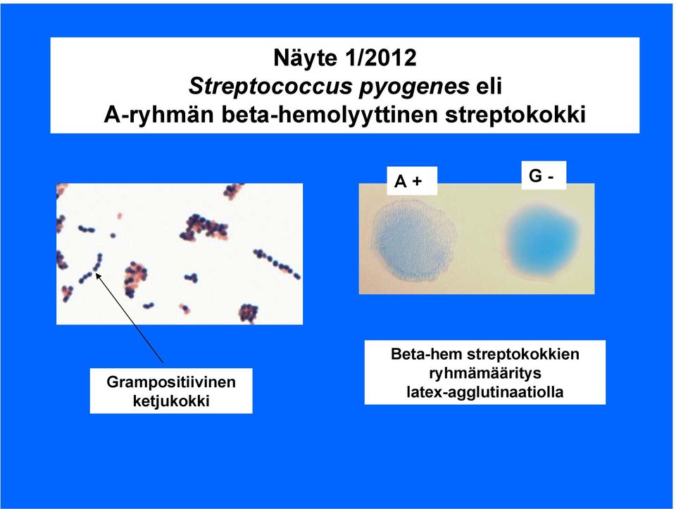 G - Grampositiivinen ketjukokki Beta-hem