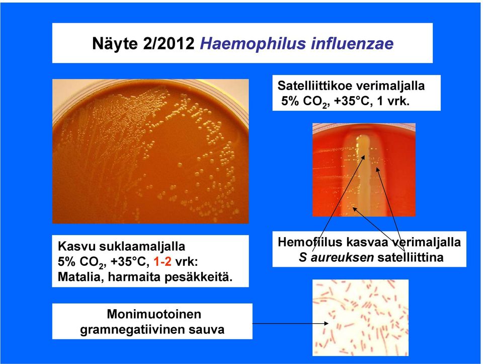 Kasvu suklaamaljalla 5% CO 2, +35 C, 1-2 vrk: Matalia, harmaita